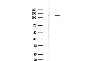 anti-MN1 proto-oncogene (MN1) (Internal Region) antibody