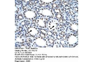 Human kidney (TDP2 antibody  (Middle Region))