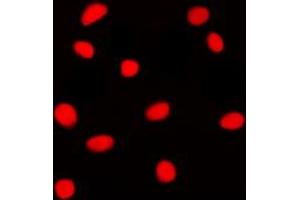 Immunofluorescent analysis of GADD153 staining in Jurkat cells. (DDIT3 antibody  (N-Term))