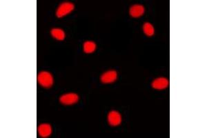 Immunofluorescent analysis of GADD153 staining in Jurkat cells.