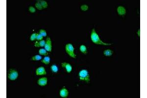 Immunofluorescent analysis of MCF-7 cells using ABIN7161936 at dilution of 1:100 and Alexa Fluor 488-congugated AffiniPure Goat Anti-Rabbit IgG(H+L) (NXF3 antibody  (AA 1-531))