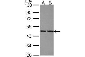 WB Image Sample (30 ug of whole cell lysate) A: 293T B: A431 , 10% SDS PAGE antibody diluted at 1:1000 (ZNF396 antibody)