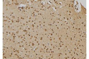 ABIN6276672 at 1/100 staining Mouse brain tissue by IHC-P. (PTPN22 antibody  (C-Term))