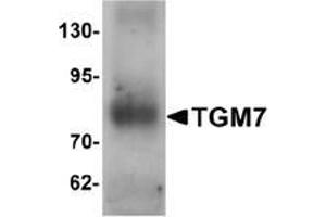 Western blot analysis of TGM7 in human lung tissue lysate with TGM7 Antibody  at 1 μg/ml. (Transglutaminase 7 antibody  (Middle Region))