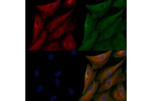 ABIN6262787 and ABIN6266575 staining  cells by IF/ICC. (Cytokeratin 7 antibody  (C-Term))