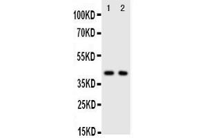 Anti-CXCR5 antibody, Western blotting Lane 1: Rat Spleen Tissue Lysate Lane 2: HELA Cell Lysate (CXCR5 antibody  (C-Term))