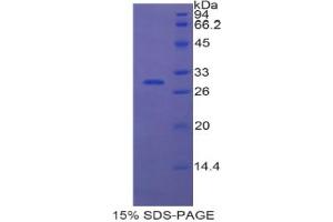 SDS-PAGE analysis of Human ETFa Protein. (Electron-Transfer-Flavoprotein, alpha Polypeptide (ETFA) Peptide)