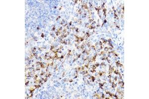 Immunohistochemistry (IHC) image for anti-Chitinase 3-Like 1 (Cartilage Glycoprotein-39) (CHI3L1) (AA 22-240) antibody (ABIN3022445)