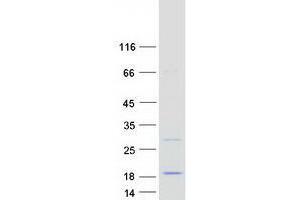Validation with Western Blot (WIT1 Protein (Myc-DYKDDDDK Tag))