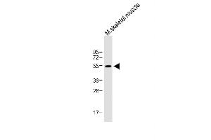 Anti-X7 Antibody (C-term) at 1:1000 dilution + Mouse skeletal muscle lysate Lysates/proteins at 20 μg per lane.