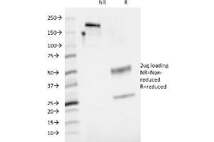 SDS-PAGE Analysis Purified CD48 Mouse Monoclonal Antibody (5-4. (CD48 antibody)