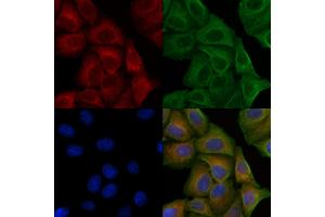 ABIN6256507 and ABIN6267633 staining H2O2 treated Hela cells by IF/ICC. (PAK1 antibody  (pThr212))