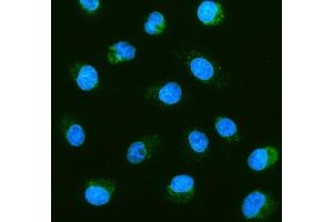 IF analysis of Prohibitin/PHB using anti-Prohibitin/PHB antibody (ABIN7599170).