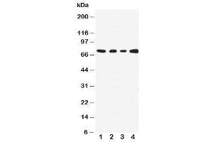 Western blot testing with MEKK3 antibody;  Lane 1: HeLa;  2: A431;  3: MCF-7;  4: Jurkat cell lysate. (MAP3K3 antibody  (N-Term))