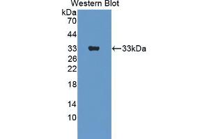 Western blot analysis of the recombinant protein. (ERBB3 antibody  (AA 707-964))