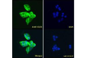 ABIN184714 Immunofluorescence analysis of paraformaldehyde fixed HepG2 cells, permeabilized with 0. (NQO1 antibody  (C-Term))