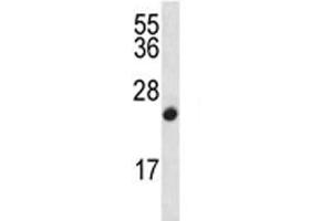 CDKN2B antibody western blot analysis in CEM lysate