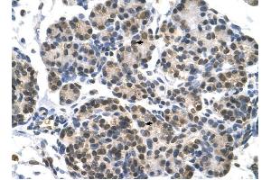 DHX9 antibody was used for immunohistochemistry at a concentration of 4-8 ug/ml to stain Epithelial cells of pancreatic acinus (arrows) in Human Pancreas. (DHX9 antibody)