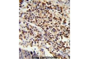 Immunohistochemistry (IHC) image for anti-U2 Small Nuclear RNA Auxiliary Factor 1 (U2AF1) antibody (ABIN3001639) (U2AF1 antibody)