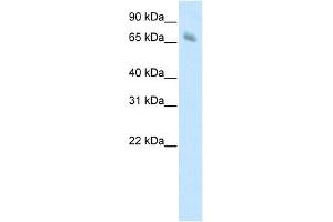 KBTBD10 antibody (20R-1206) used at 0. (Kelch-like protein 41 (KLHL41) (C-Term) antibody)