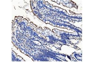 IHC analysis of CD13/ANPEP using anti-CD13/ANPEP antibody (ABIN7600089). (CD13 antibody  (AA 148-966))