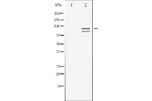 Western blot analysis of Glycogen Synthase phosphorylation expression in PMA treated NIH-3T3 whole cell lysates,The lane on the left is treated with the antigen-specific peptide.