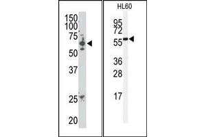Image no. 1 for anti-SUMO1/sentrin/SMT3 Specific Peptidase 2 (SENP2) (C-Term) antibody (ABIN356752) (SENP2 antibody  (C-Term))