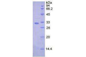 Image no. 1 for Cathepsin L2 (CTSL2) (AA 64-334) (Active) protein (His tag) (ABIN6239914) (Cathepsin L2 Protein (CTSL2) (AA 64-334) (His tag))