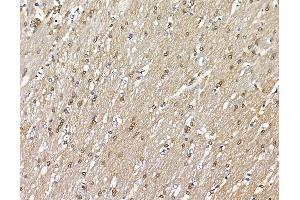 ABIN6264451 and ABIN6279641 at 1/100 staining rat brain tissue by IHC-P. (PRRX2 antibody  (Internal Region))