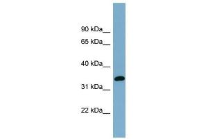 AWAT1 antibody used at 1 ug/ml to detect target protein.