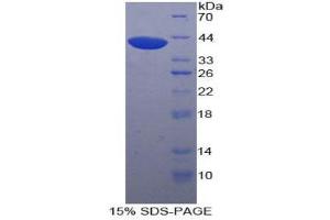 SDS-PAGE (SDS) image for UDP Glycosyltransferase 8 (UGT8) (AA 198-541) protein (His tag) (ABIN1877706)