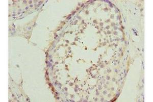 Immunohistochemistry of paraffin-embedded human testis tissue using ABIN7171132 at dilution of 1:100 (SYCE1 antibody  (AA 132-351))