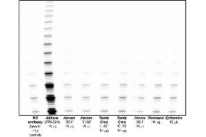Antibodies and their commercial vendor are described, based on immunoprecipitation of telomerase from HEK-293 tumour cell lysates, followed by a 1 hr elution in the presence of antigenic peptide, if available. (hTERT antibody)