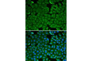 Immunofluorescence analysis of HeLa cells using SPINK1 antibody. (SPINK1 antibody)