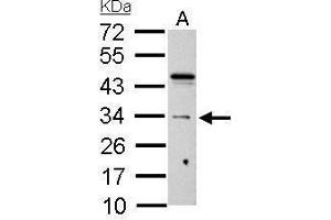 WB Image HUS1 antibody detects HUS1 protein by Western blot analysis.