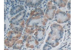 DAB staining on IHC-P; Samples: Human Stomach Tissue (FLG2 antibody  (AA 1915-2143))