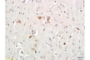 Formalin-fixed and paraffin embedded rat brain labeled with Anti-Persephin Polyoclonal Antibody, Unconjugated (ABIN687667) followed by conjugation to the secondary antibody and DAB staining (Persephin antibody  (AA 51-156))