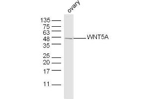 Mouse ovary lysates probed with WNT5A Polyclonal Antibody, unconjugated  at 1:300 overnight at 4°C followed by a conjugated secondary antibody at 1:10000 for 90 minutes at 37°C. (WNT5A antibody  (AA 301-381))