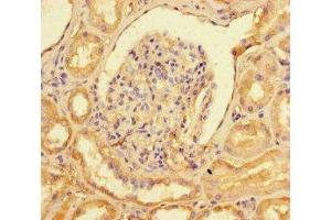 Immunohistochemistry of paraffin-embedded human kidney tissue using ABIN7148641 at dilution of 1:100 (NR2F2 antibody  (AA 123-383))