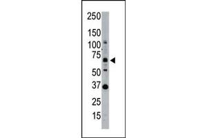 Western blot analysis of SENP1 polyclonal antibody  in whole HL60 cell lysate: SENP1 (Arrow) was detected using purified Pab. (SENP1 antibody  (N-Term))