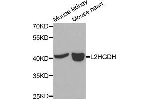 Western blot analysis of extracts of mouse kidney and mouse heart cells, using L2HGDH antibody.