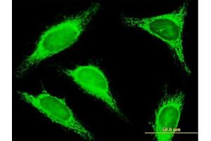 Immunofluorescence of purified MaxPab antibody to TRDD3 on HeLa cell. (TRDD3 antibody  (AA 1-296))