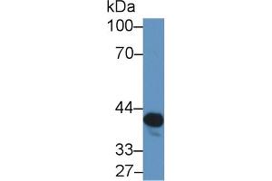 Detection of NAT2 in Rat Serum using Polyclonal Antibody to N-Acetyltransferase 2 (NAT2) (NAT2 antibody  (AA 20-280))