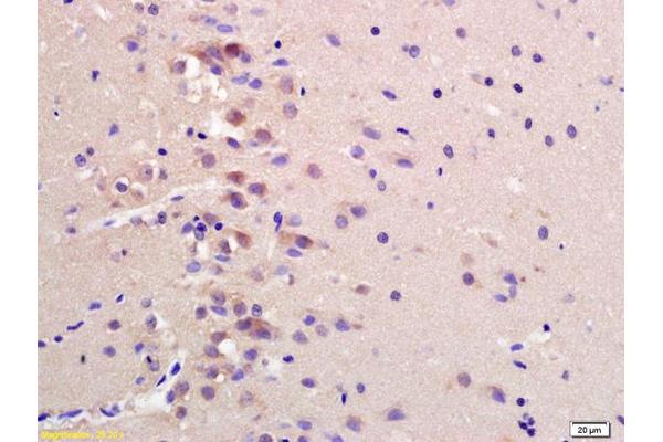 CCDC61 antibody  (AA 265-370)