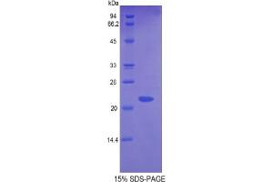 SDS-PAGE analysis of Mouse Glyoxalase I Protein. (GLO1 Protein)