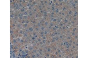 Used in DAB staining on fromalin fixed paraffin- embedded liver tissue (TNKS2 antibody  (AA 959-1166))
