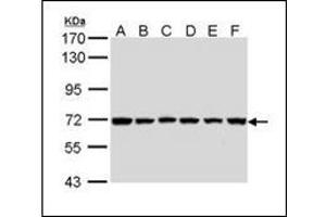 Sample (30 µg of whole cell lysate). (BIRC3 antibody)