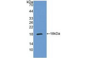 Detection of Recombinant IL5Ra, Human using Polyclonal Antibody to Interleukin 5 Receptor Alpha (IL5Ra) (IL5RA antibody  (AA 42-182))