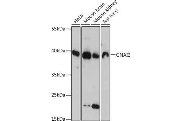 GNAI2 抗体  (AA 1-355)