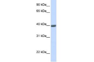MAGEA1 antibody used at 1 ug/ml to detect target protein.